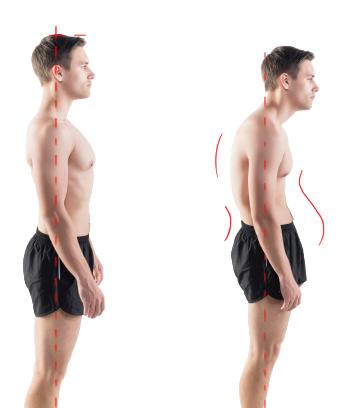 upper and mid back poor posture